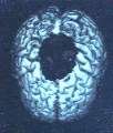 Brain of Konrad Paul Koerding